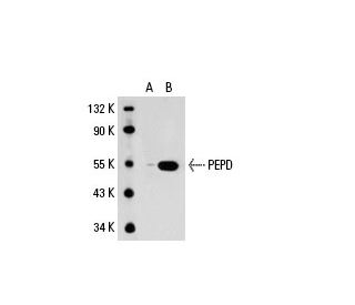 PEPD Antibody (47-Q) - Western Blotting - Image 19709 