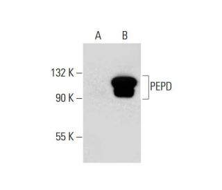 PEPD Antibody (47-Q) - Western Blotting - Image 130016