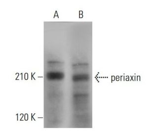 periaxin Antibody (G-5) - Western Blotting - Image 379199 