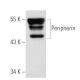 Peripherin Antibody (8G2) - Western Blotting - Image 32526