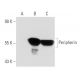 Peripherin Antibody (8G2) - Western Blotting - Image 48204 