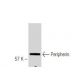 Peripherin Antibody (8G2) - Western Blotting - Image 67339 