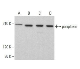 periplakin Antibody (AE11) - Western Blotting - Image 383790 