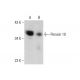 Peroxin 10 Antibody (Y-2D3) - Western Blotting - Image 384299 