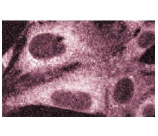Peroxin 5 Antibody (50) - Immunofluorescence - Image 60530 