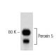 Peroxin 5 Antibody (50) - Western Blotting - Image 60205 