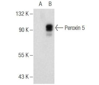 Peroxin 5 Antibody (F-10) - Western Blotting - Image 146577