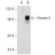 Peroxin 5 Antibody (F-10) - Western Blotting - Image 146577