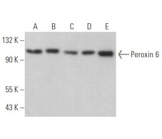 Peroxin 6 Antibody (F-6) - Western Blotting - Image 368941 