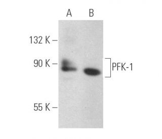 PFK-1 Antibody (E-4) - Western Blotting - Image 389879 