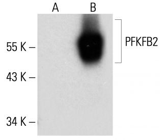 PFK-2/PFKFB2 Antibody (D-1) - Western Blotting - Image 284380