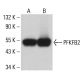 PFK-2/PFKFB2 Antibody (G-7) - Western Blotting - Image 361628 