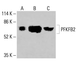 PFK-2/PFKFB2 Antibody (G-7) - Western Blotting - Image 416031 