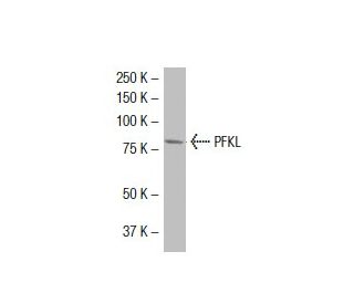 PFKL Antibody (YT4) - Western Blotting - Image 33914