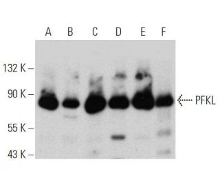 PFKL Antibody (A-6) - Western Blotting - Image 359514Each CRISPR/Cas9 Knockout (KO) Plasmid product consists of a pool of 3 plasmids designed to ensure identification and cleavage of a specific gene for maximum knockout efficiency. Each plasmid encodes a unique 20 nt sequence derived from the GeCKO (v2) library.