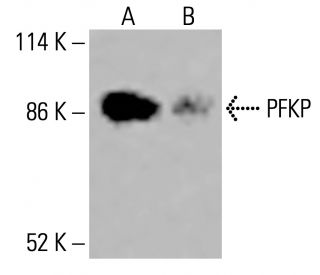 PFKP Antibody (F-7) - Western Blotting - Image 415710