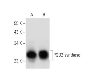 PGD2 synthase Antibody (F-7) - Western Blotting - Image 299011 