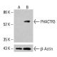 Anticorpo PHACTR3 (H-3): sc-390843. Analisi mediante Western blot dell'espressione di PHACTR3 in lisati cellulari completi K-562 non trattati (A) e trattati chimicamente (B). β-Actina (C4): sc-47778 utilizzato come controllo di caricamento. Reagente di rilevamento utilizzato: m-IgG Fc BP-HRP: sc -525409. PHACTR3 Antibody (H-3) - Western Blotting - Image 415168