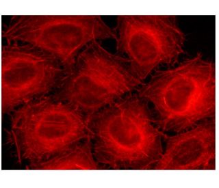 Phalloidin CruzFluor&trade; 532 Conjugate: sc-363793. Fluorescence staining of formalin-fixed HeLa cells showing F-actin s 