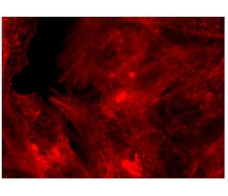 Phalloidin CruzFluor&trade; 555 Conjugate: sc-363794. Fluorescence staining of formalin-fixed HepG2 cells showing F-actin 