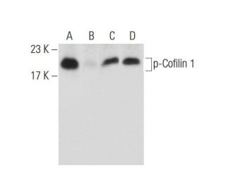 Phenylarsine oxide: sc-3521. Western blot analysis of Cofilin 1 phosphorylation in K-562 (A), lambda phosphatase (sc-20031 