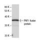PHF1 Antibody (864C6a) - Western Blotting - Image 47873
