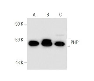 PHF1 Antibody (864C6a) - Western Blotting - Image 66162 