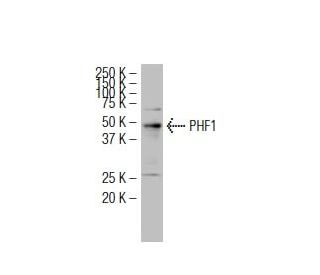 PHF1 Antibody (SK-J6) - Western Blotting - Image 34470 