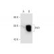 PHF1 Antibody (SK-J6) - Western Blotting - Image 66158 