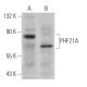 PHF21A Antibody (F-9) - Western Blotting - Image 366971