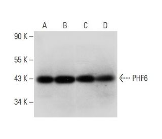 PHF6 Antibody (B-9) - Western Blotting - Image 325144 