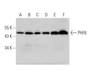 PHF6 Antibody (C-6) - Western Blotting - Image 325142 