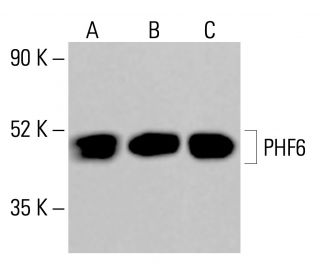 PHF6 Antibody (G-9) - Western Blotting - Image 414114 