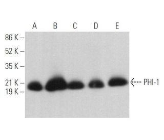 PHI-1 Antibody (C-11) - Western Blotting - Image 369842 