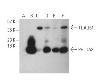 PHLDA3 Antibody (A-10) - Western Blotting - Image 401042