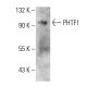 PHTF1 Antibody (PHTF1R8) - Western Blotting - Image 385127