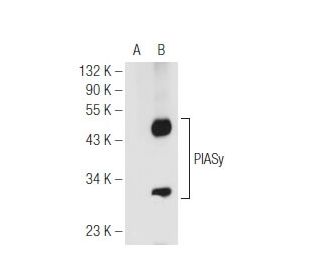 PIASy Antibody (F-9) - Western Blotting - Image 99704