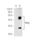 PIASy Antibody (F-9) - Western Blotting - Image 99704