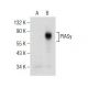 PIASy Antibody (H-9) - Western Blotting - Image 155100 