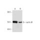 Piceatannol: sc-200610. Western blot analysis of cyclin B1 expression in untreated (A) and Piceatannol treated (B) HCT 116