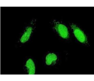 PICT-1 Antibody (5A8) - Immunofluorescence - Image 351776 