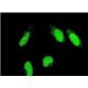PICT-1 Antibody (5A8) - Immunofluorescence - Image 351776 