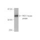 PICT-1 Antibody (5A8) - Western Blotting - Image 349573