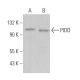 PIDD Antibody (B-5) - Western Blotting - Image 364424