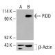 PIDD Antibody (B-5) - Western Blotting - Image 415843