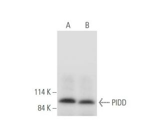 PIDD Antibody (B-5) - Western Blotting - Image 333663Each CRISPR/Cas9 Knockout (KO) Plasmid product consists of a pool of 3 plasmids designed to ensure identification and cleavage of a specific gene for maximum knockout efficiency. Each plasmid encodes a unique 20 nt sequence derived from the GeCKO (v2) library.