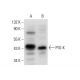 PIG-K Antibody (G-6) - Western Blotting - Image 306570 