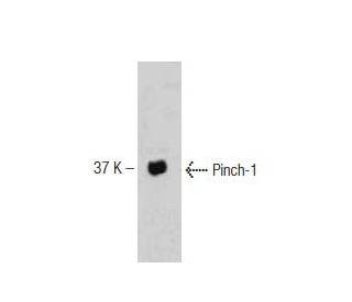 Pinch-1 Antibody (49) - Western Blotting - Image 127490 