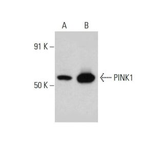 PINK1 Antibody (38CT20.8.5) - Western Blotting - Image 384286Each CRISPR/Cas9 Knockout (KO) Plasmid product consists of a pool of 3 plasmids designed to ensure identification and cleavage of a specific gene for maximum knockout efficiency. Each plasmid encodes a unique 20 nt sequence derived from the GeCKO (v2) library.