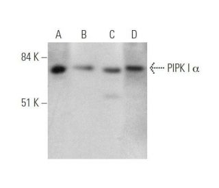 PIPK I &alpha; Antibody (D-4) - Western Blotting - Image 351701 